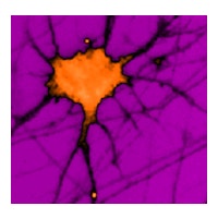 Pgonghomqweytr0dnmdg pvneurologo3